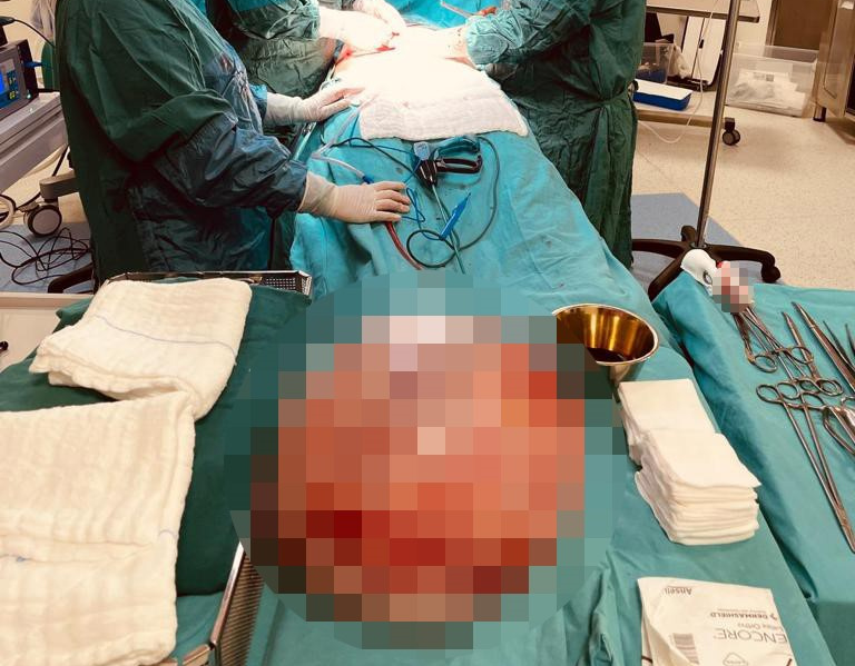 Kocaeli'de hamile olduğunu sanan kadının karnından bakın ne çıktı