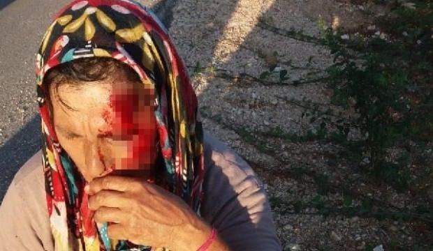 Kocaeli'de koç, sahibini hastanelik etti