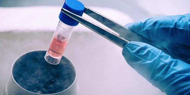 Kök hücre tedavisi nedir?