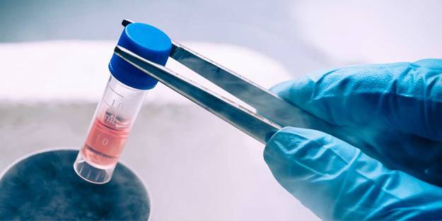 “Kök hücre tedavisiyle saç dökülmesini durdurulabilir”