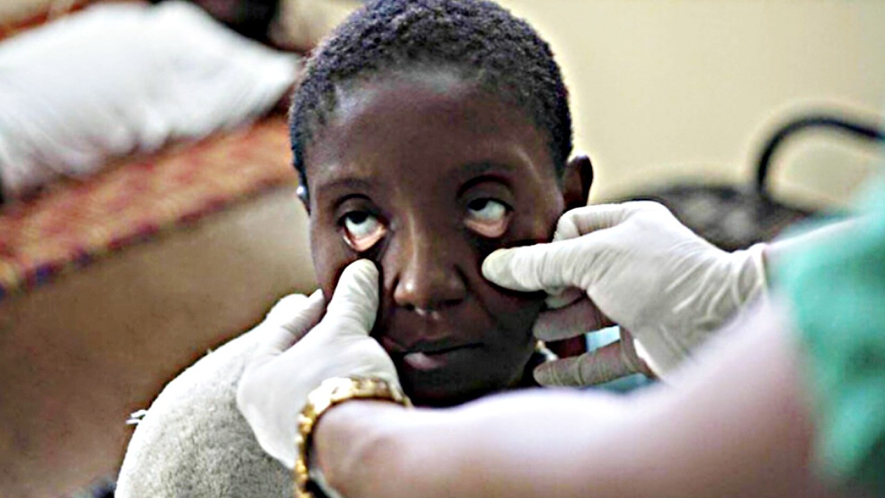 Kolera kara kıta'nın kabusu: 4 Binden fazla ölü var!