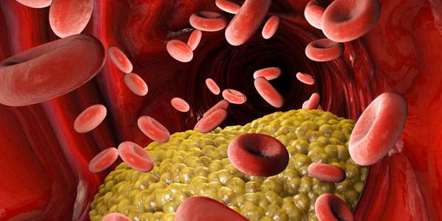 Kolesterole karşı koyan 7 besin grubu