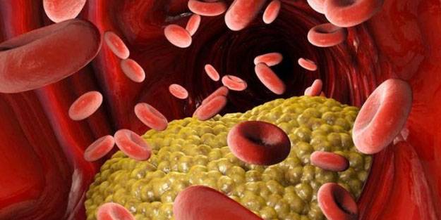 Kolesterolü düşürmek için en iyi 6 yol