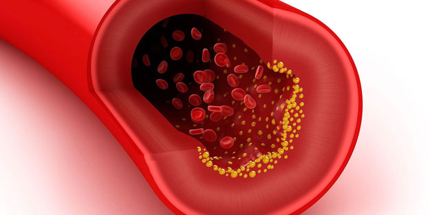 Kolesterolün çeşitleri ve belirtileri nelerdir? Kolesterol düşüren besinler...