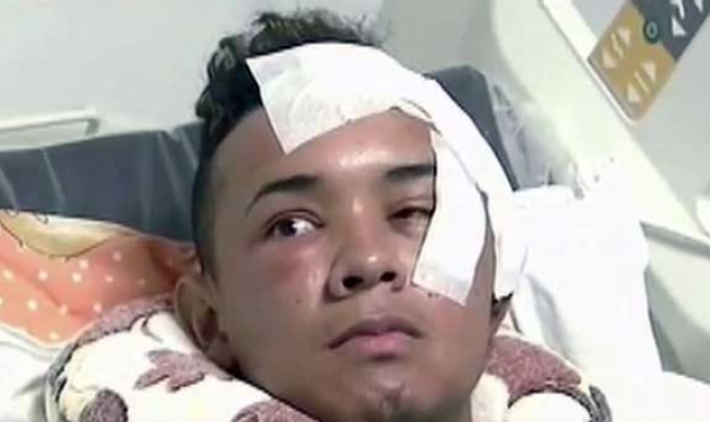 Kolombiya'da gözüne bıçak saplanan adamın beyni delindi