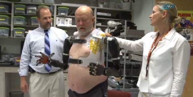  Kolsuz hastaya beyinle yönetilen kollar takıldı