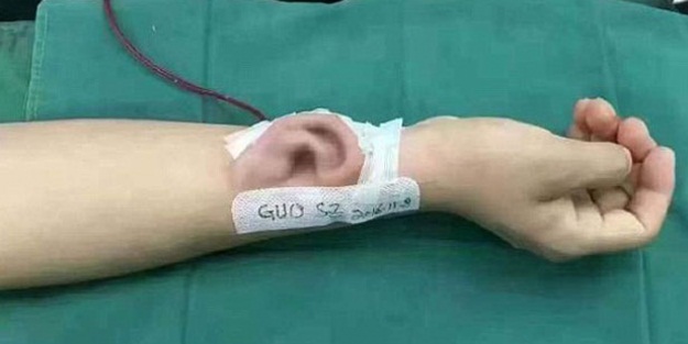 Koluna 'kulak' yaptılar