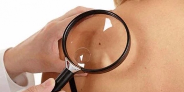 Kolunuzda 11'den fazla ben varsa...