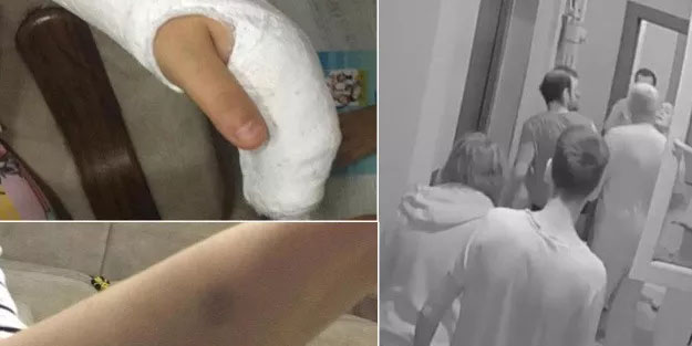 Komşu kavgası: Hamile eşinin parmakları kırıldı, kendisi yumruklandı!