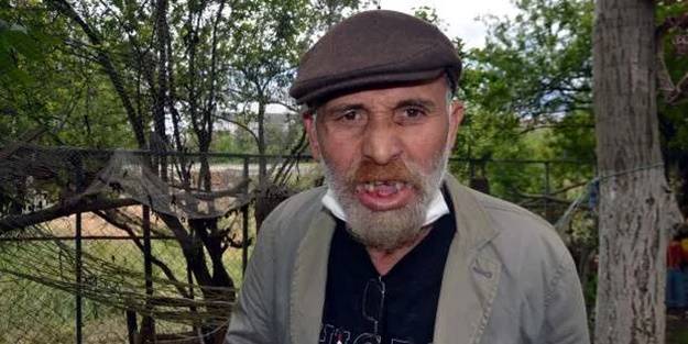 Komşular arasında çıkan kavga büyüdü! Keserle 3 dişini kırdı