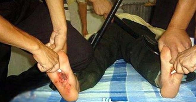 Uygur Türk'üne hapishanede işkence