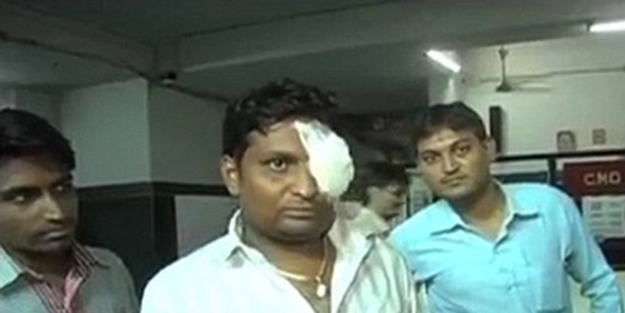 Konuşma esnasında telefonu patladı