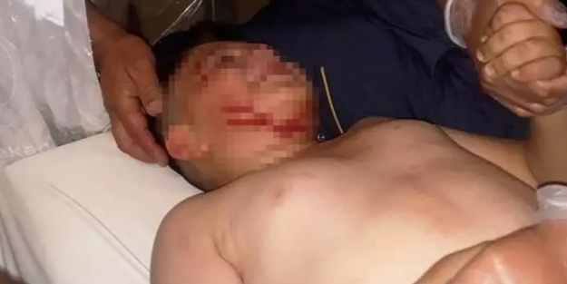 Konya'da başıboş köpek dehşeti... Tam 40 dikiş atıldı