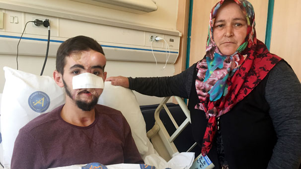 Konya'da yüzüne ateş eden genç, 37'nci kez ameliyat olacak