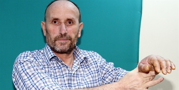 Kopan kolunu hastaneye götürdü