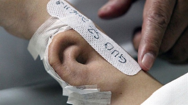 Kopan kulağını kolunda büyüttüler