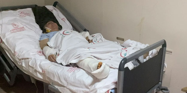 Köpeğin saldırısına uğrayan kadının tedavisi sürüyor