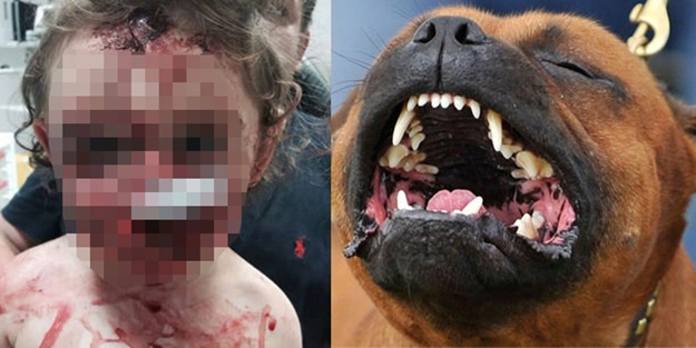 Köpek 18 aylık bebeği bu hale getirdi!