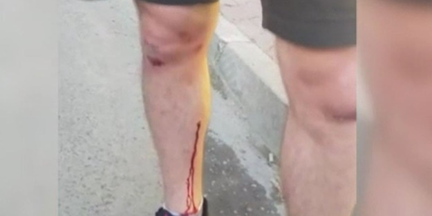 Köpek dehşetine uğrayan adam isyan etti