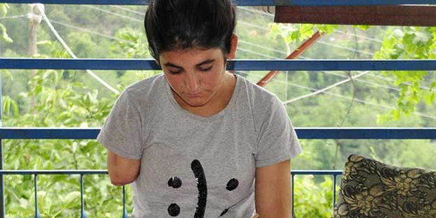 Köpek ısırdı, kolunu kaybetti! Protez için 50 bin euro lazım