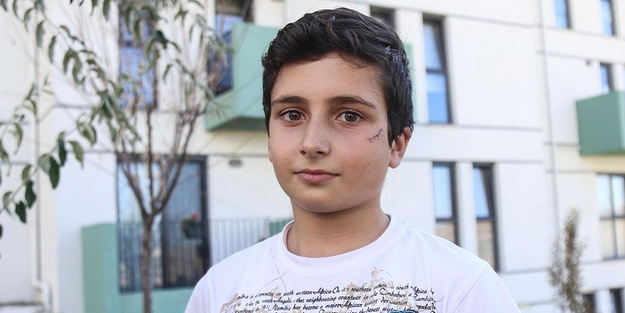 Köpek saldırısı: 9 yaşındaki çocuk yüzünden yaralandı!