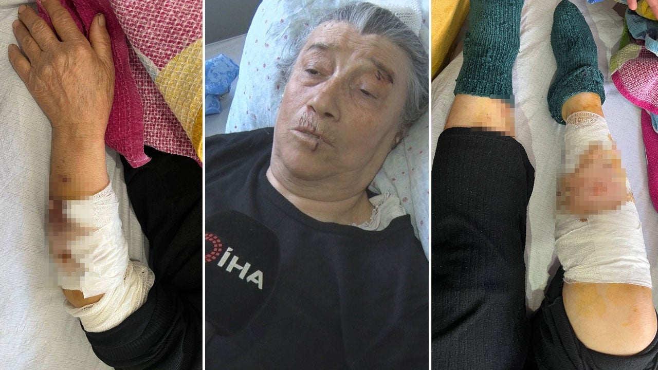 Köpek terörünün ortasında kaldı: Kolumu, elimi, başımı ve bacağımı parçaladılar