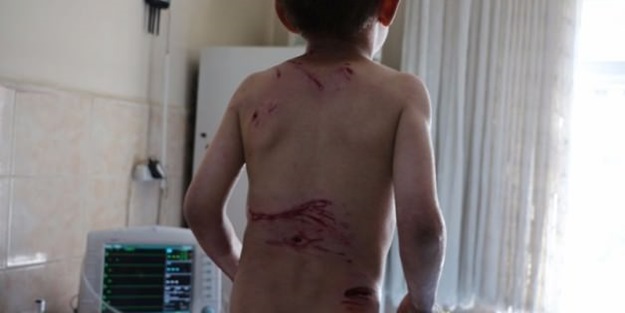 Köpekler saldırdı!