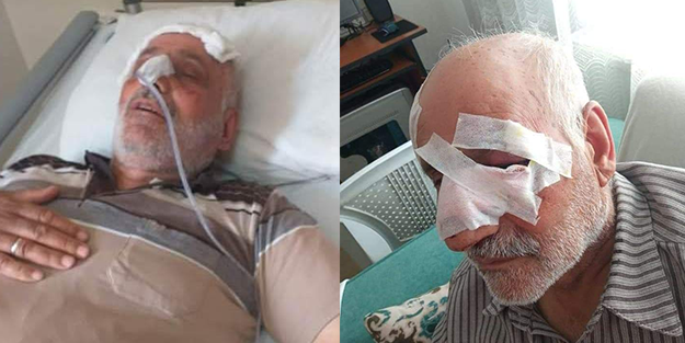 Köpeklerin saldırdığı yaşlı adam kurtarılamadı