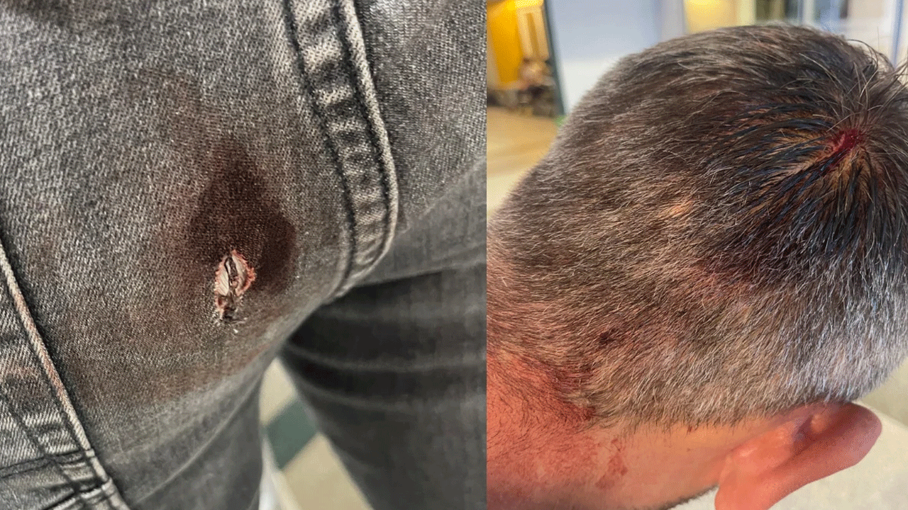 Köpekperestler iyice delirdi! Barınağı basıp zabıta bıçakladılar