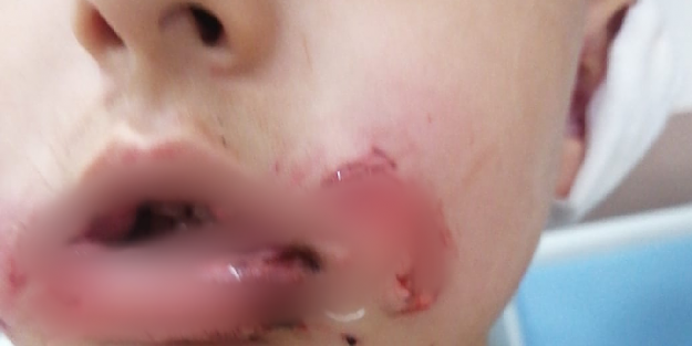 Köpekperestlerin barınaklardan kaçırdığı pitbull'lar dehşet saçıyor! Küçük çocuğun dudağı ve kulağı parçalandı