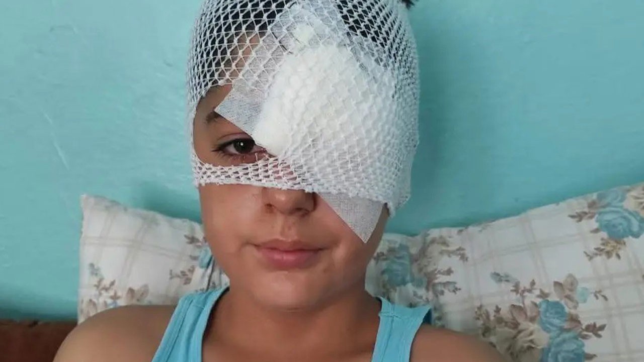 Köpekten kaçarken otomobil çarptı