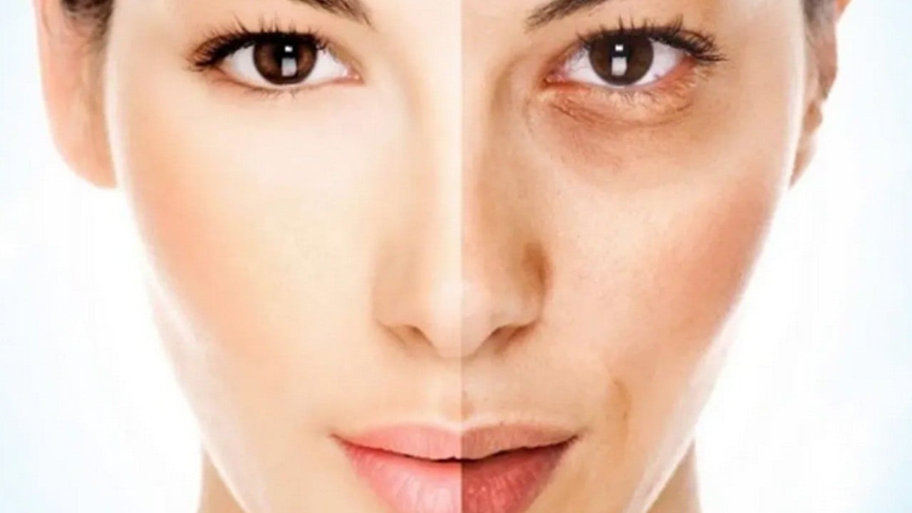 Korelilerin cam gibi ciltlerinin sırrı! Mide bulandıran etkisi ile şaşırtıyor