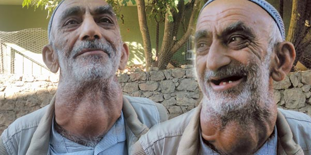 Korktuğu için ameliyat olmadı! 30 yıldır boynunda kitleyle dolaşıyor