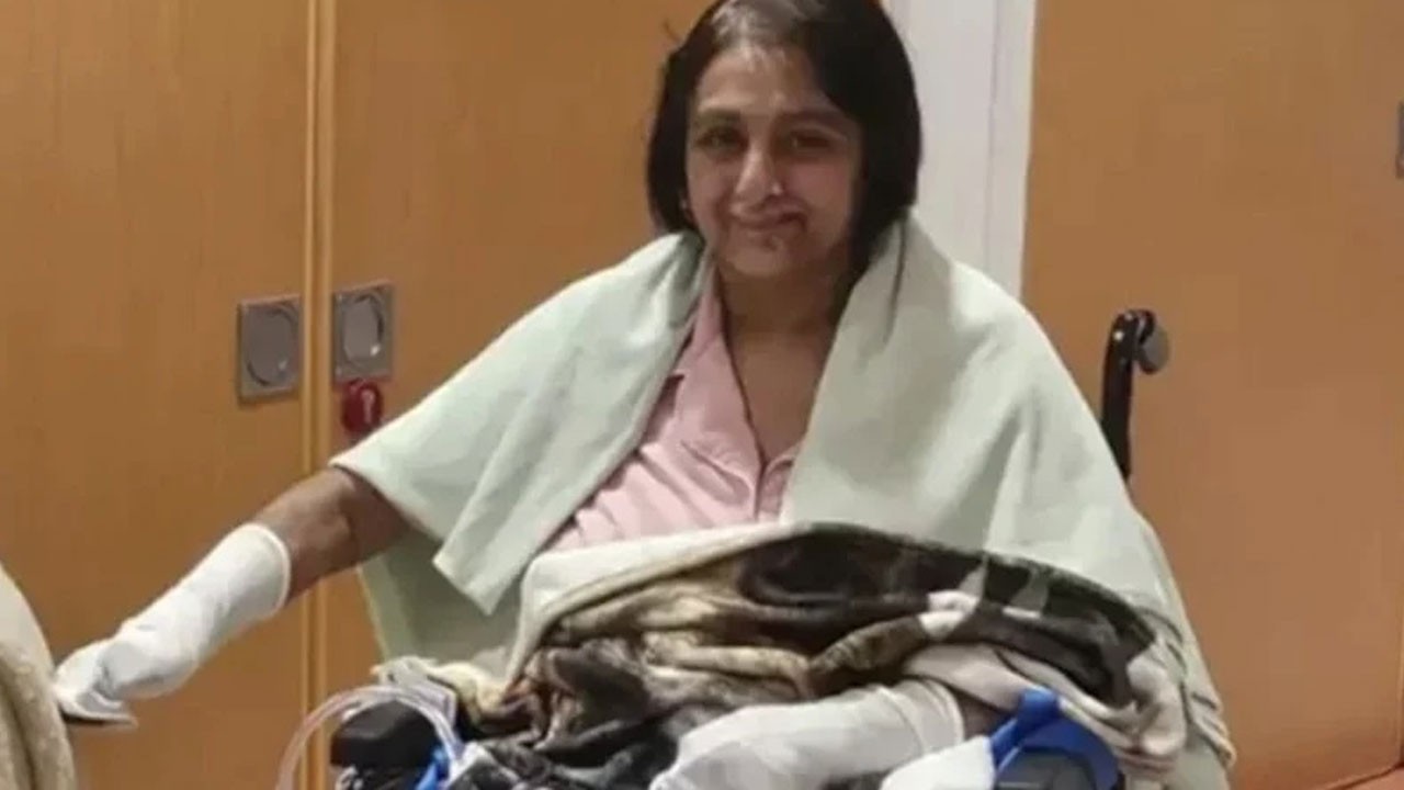 Korkunç: Köpeği yarasını yaladı, elleri ve bacakları kesildi