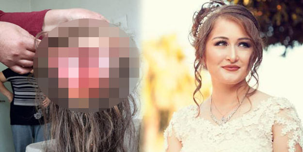 Korkunç olay! Kafa derisi koptu, o halde traktöre atlayıp...