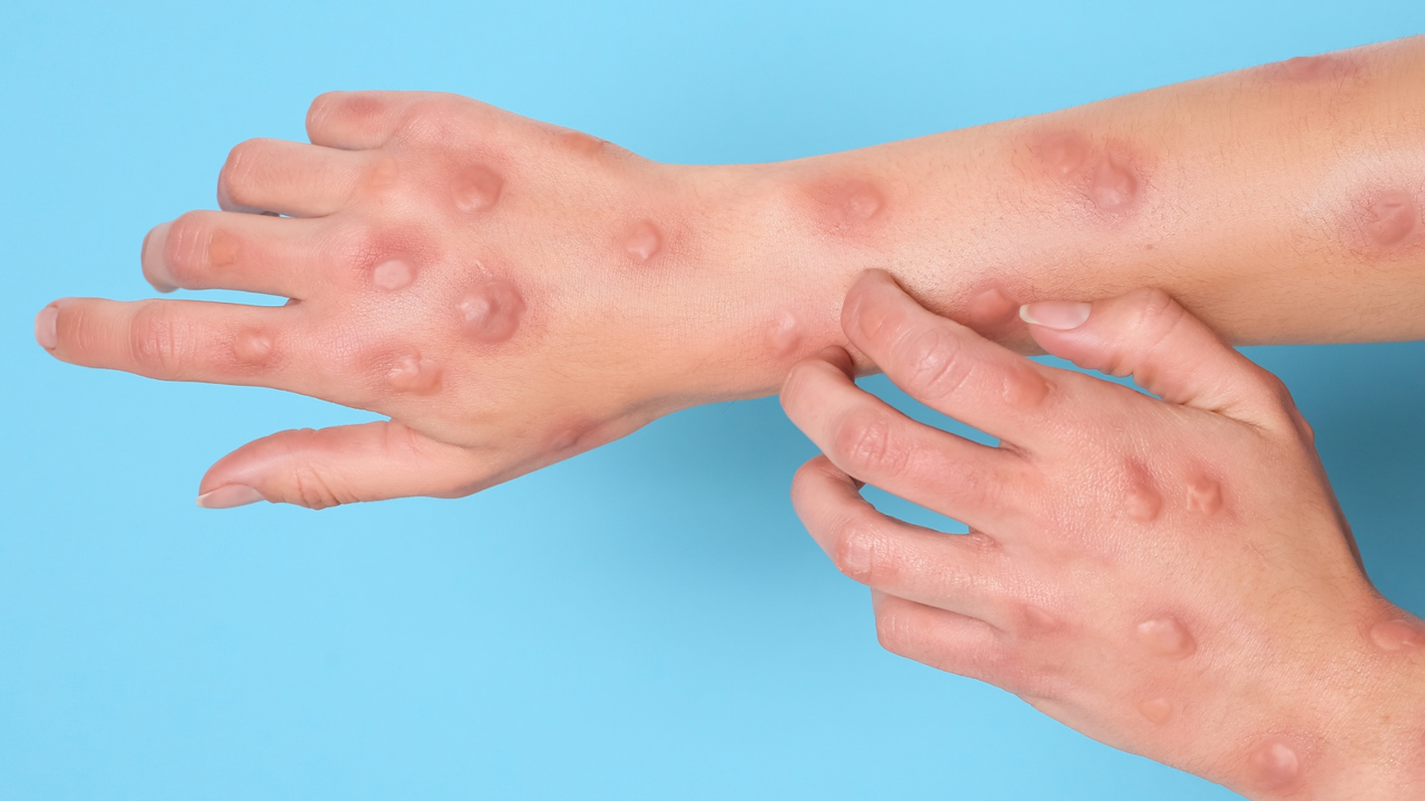 Korkunç virüs o ülkeyi esir aldı!