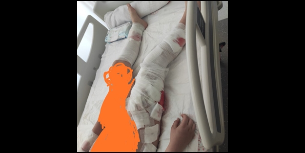 Korkutan 'kuduz' iddiası! Okula giden ilkokul öğrencisi çocuğa saldırdılar! 60'a yakın başıboş köpek toplatıldı