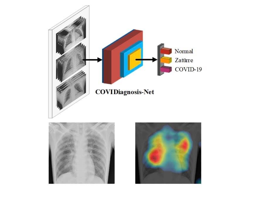 Korona virüs teşhisini kolaylaştıracak yapay zeka sistemi 