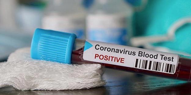 Korona virüs tespiti nasıl yapılır? Korona virüs (corona virüs) testi nasıl yapılır?