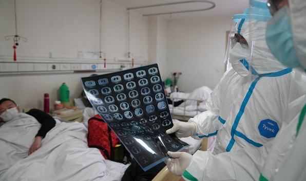 Korona virüsü ölümcül mü?