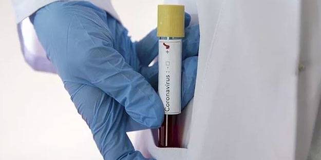 Koronavirüs araştırmasında ortaya çıktı! Yüzde 35 artırıyor