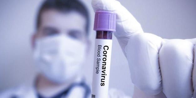 Koronavirüs aşı bulundu mu? Son dakika koronavirüs gelişmesi