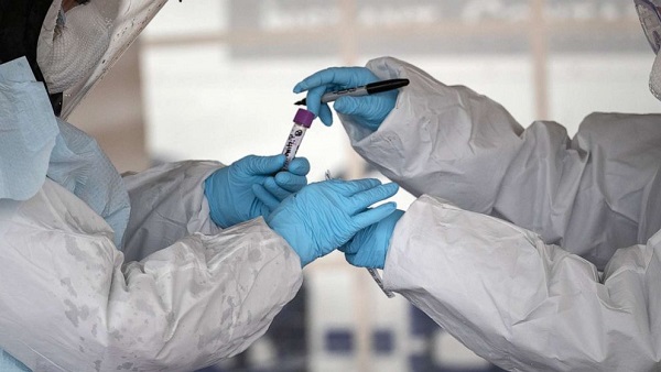 Koronavirüs belirtileri nelerdir? Korona mı oldum?