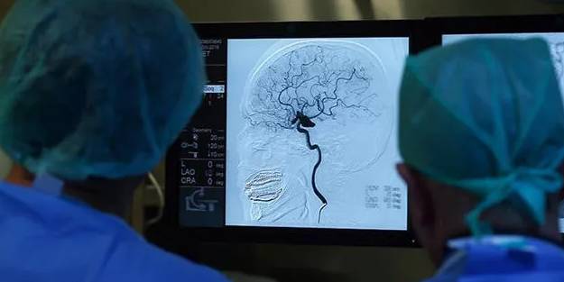 Koronavirüs felç riskini artırabilir