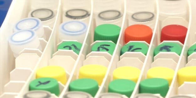 Koronavirüs hızlı tanı testi ne kadar zamanda sonuçlanır?