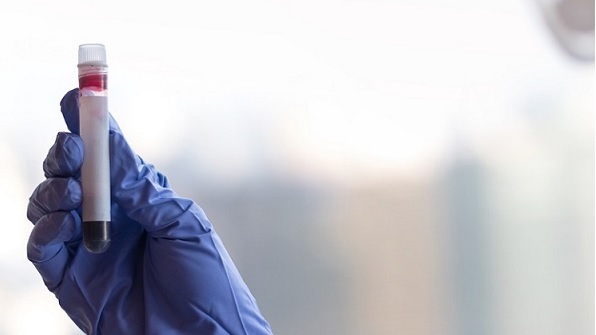 Koronavirüs kaç kişide var? | Koronavirüs son durum 18 Mart