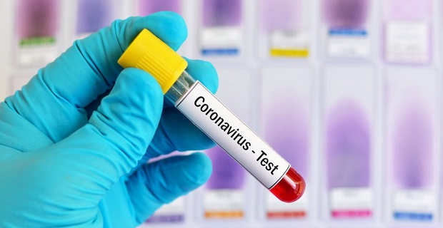 Koronavirüs ne zaman geçecek? Coronavirüs nasıl biter?