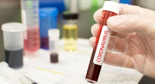 Koronavirüs nedeniyle hac iptal mi edilecek son dakika haberi