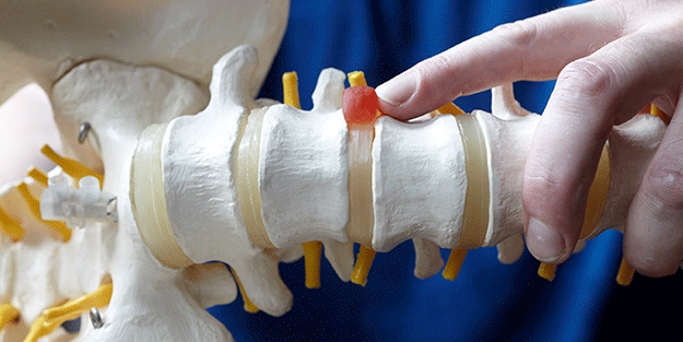 Koronavirüs sürecinde 'Boyun Fıtığı' vakalarında artış!