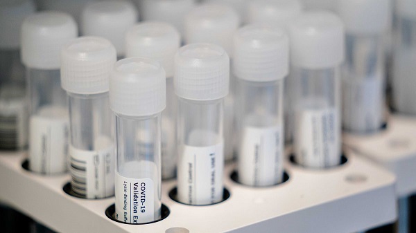 Koronavirüs tedavisi bulundu mu? | Aşı olmadan koronavirüs tedavi edilecek mi?